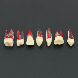 10 stuks tandheelkundige endodontische wortelkanaalbehandeling praktijk endo tanden model