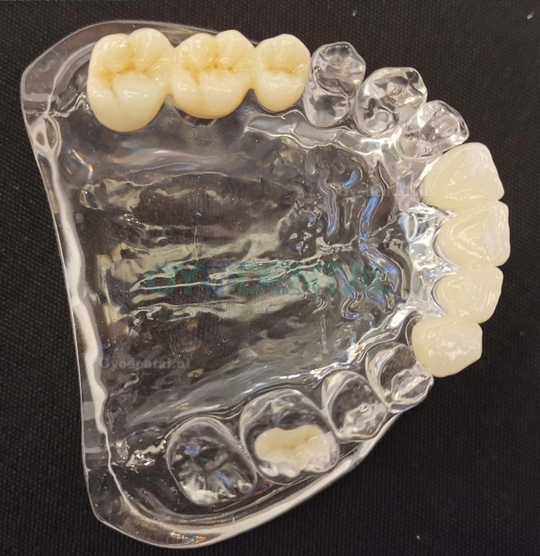 1 Stks 3D Laboratorium Meerlaags Zirconia Blok Zirkoniumoxide schijven CAD/CAM Keramisch Blok