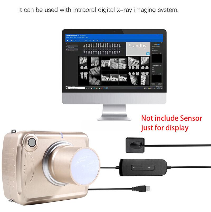 Digitale draagbare tandheelkundige röntgenunit met hoge frequentie beeldcamera