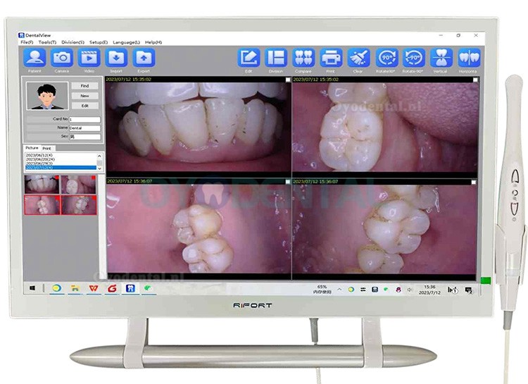 Magenta YF-2200P+ 21,5 inch LCD-monitor touchscreen intraorale camera VGA + HDMI