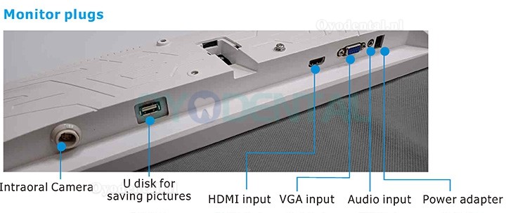 Magenta YF-2400M Wifi tandheelkundige intraorale camera met 24 inch monitor en ijzeren beugel