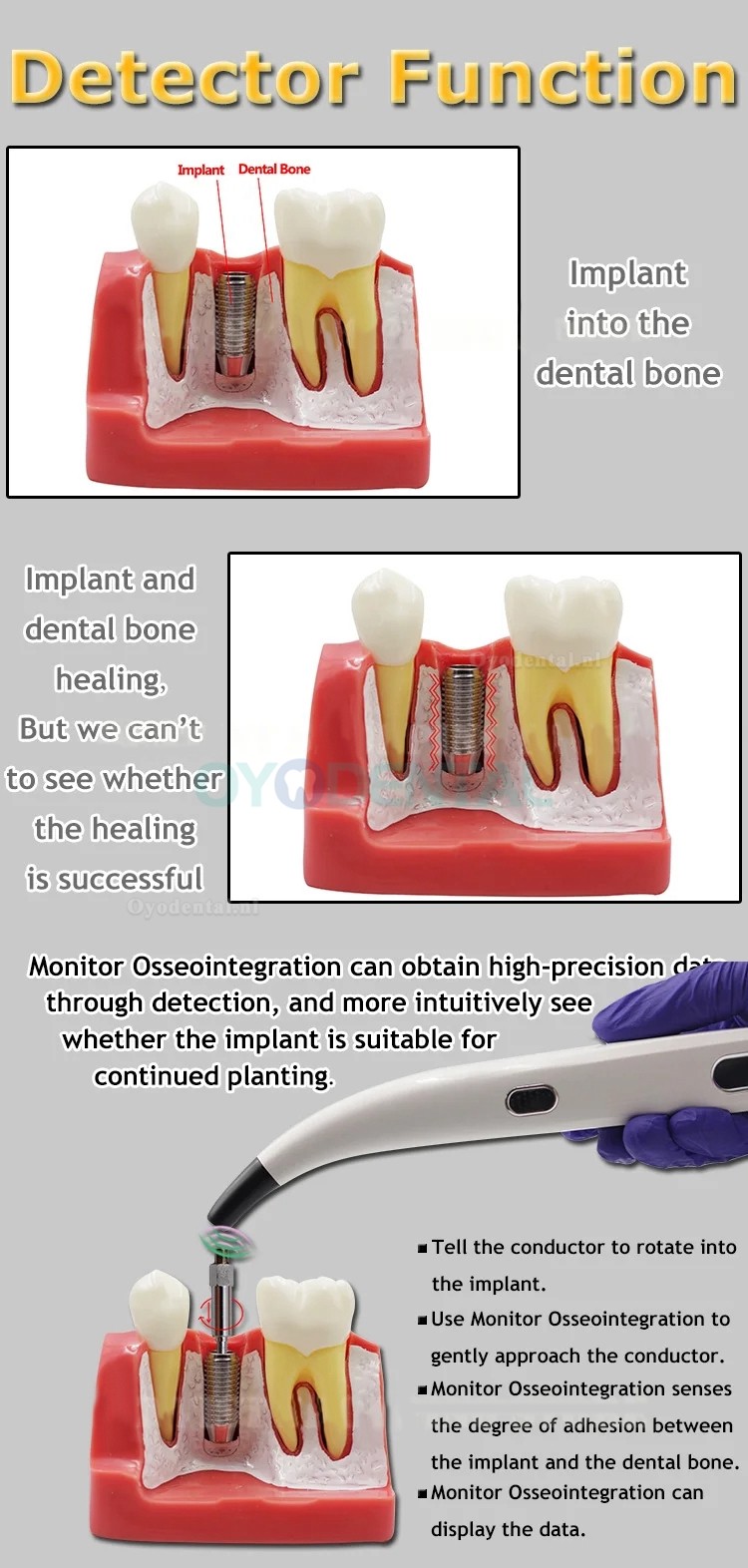 Tandheelkundige ISQ Implantaatstabiliteitsmonitor Implantaatstabiliteitsmeter