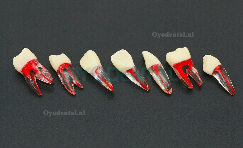 10 stuks tandheelkundige endodontische wortelkanaalbehandeling praktijk endo tanden model