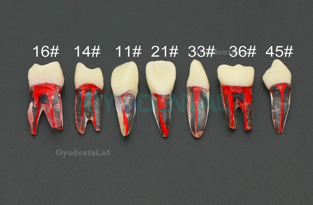 10 stuks tandheelkundige endodontische wortelkanaalbehandeling praktijk endo tanden model