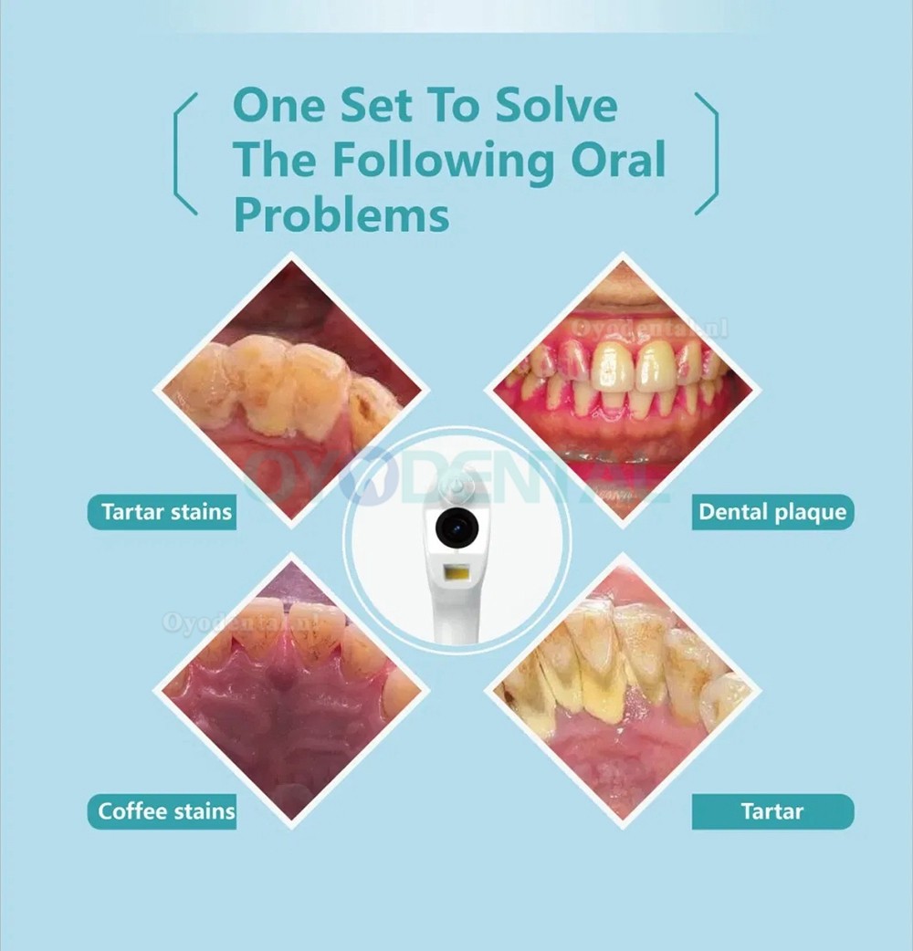 Waterdichte tandheelkundige orale draadloze WiFi intraorale camera voor thuisgebruik van mobiele telefoons