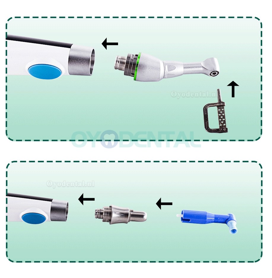 Tandheelkundige elektrische draadloze IPR-handstuk orthodontische en polijstmotor