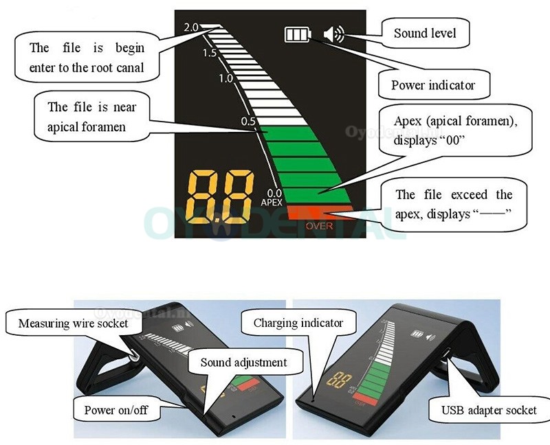 Westcode Tandheelkundige mini-apexlocator endodontische wortelkanaalzoeker meetinstrument