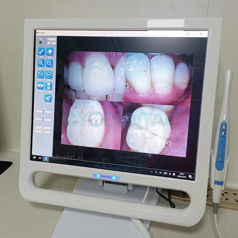 YF-1700P+ 17 inch tandheelkundige intraorale camera touchscreen LCD-scherm voor tandheelkundige unit met beugel