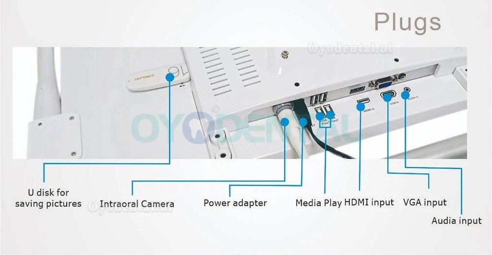 YF-2200M 21,5 inch tandheelkundige HD intraorale camera met monitorscherm met beugel voor tandartsstoel