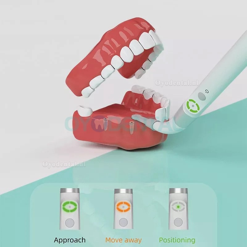 YAHOPE iD1 Tandheelkundige implantaatdetector implantaatlocator slimme 360°roterende sensor