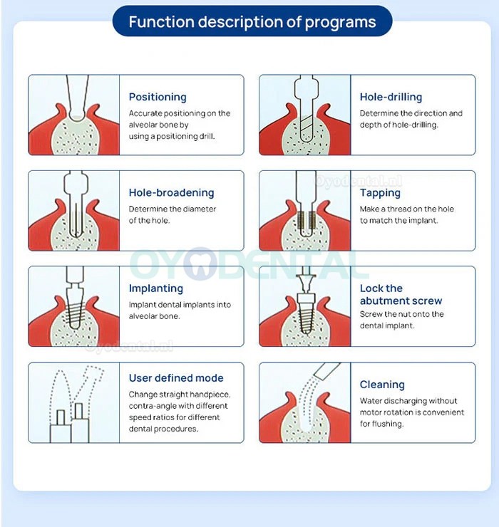 YAHOPE IMPLANT Surg Tandheelkundige implantaat-chirurgische motor zonder borstels met 20:1 LED-hoekstuk